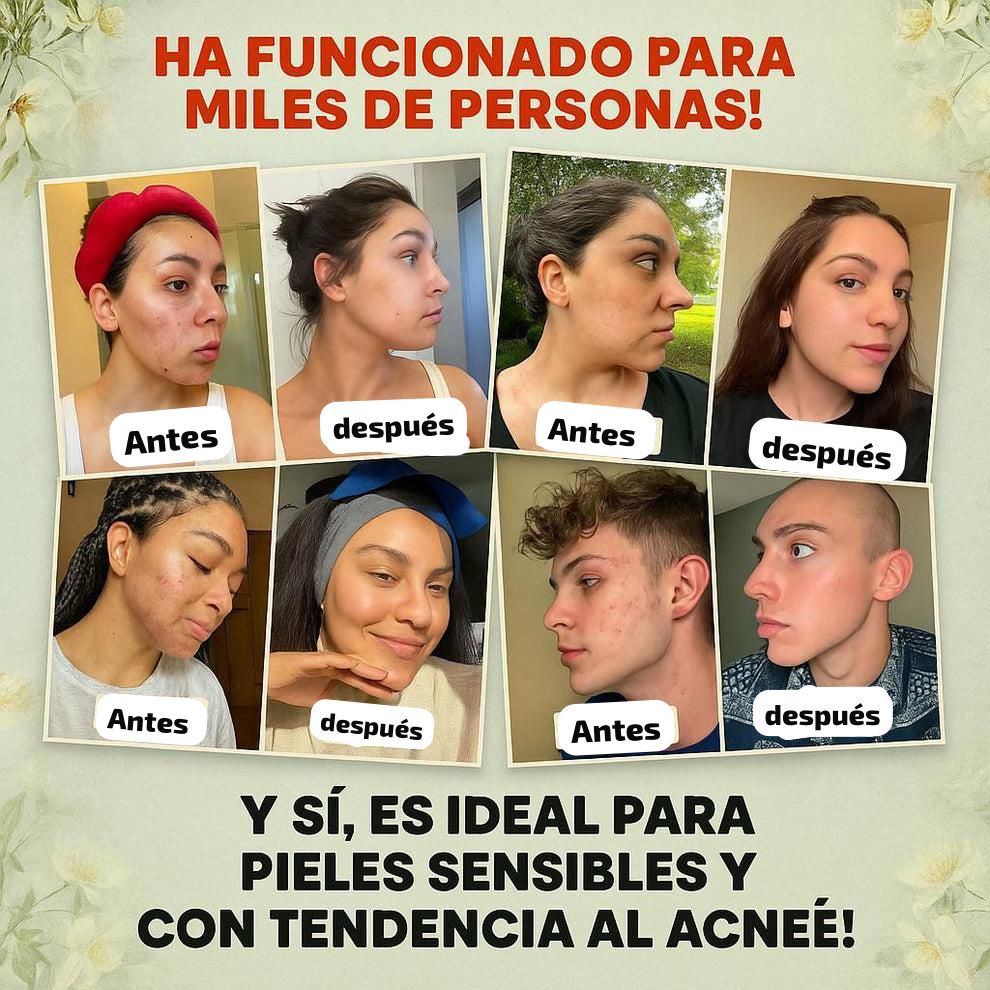 ✨ EVILGOODS™ BÁLSAMO REJUVENECEDOR – REVITALIZA TU PIEL CON SEBO DE RES Y MIEL DE MANUKA 100% NATURAL 🍯